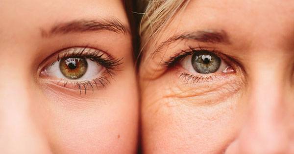 Nếp nhăn ở mắt thường xuất hiện sớm, tố cáo tuổi tác của bạn