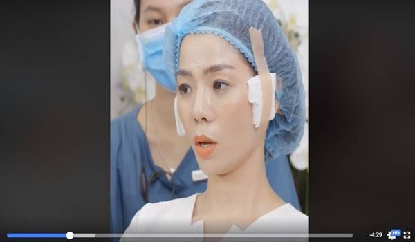 Ca sĩ Lệ Quyên căng da với sợi Collagen Gold Fiber với chuyên gia Hàn Quốc