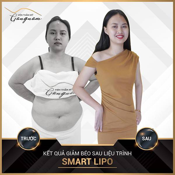 Chị Hương cũng sở hữu số đo đáng mơ ước sau 1 tháng thực hiện giảm béo toàn thân bằng Smart Lipo