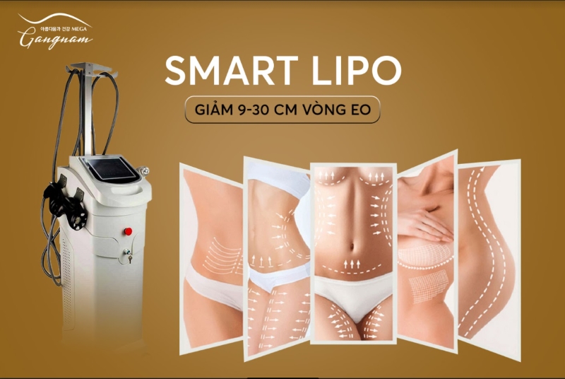 Công nghệ giảm mỡ không phẫu thuật Smart Lipo hiệu quả cho mọi vùng trên cơ thể