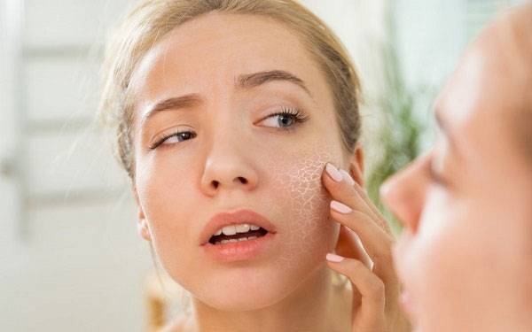 Da mặt khô dùng kem dưỡng gì? Tiêu chí lựa chọn