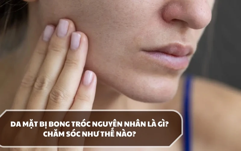 Tình trạng da mặt bị bong tróc nguyên nhân chính là do đâu? Chăm sóc bằng cách nào? 