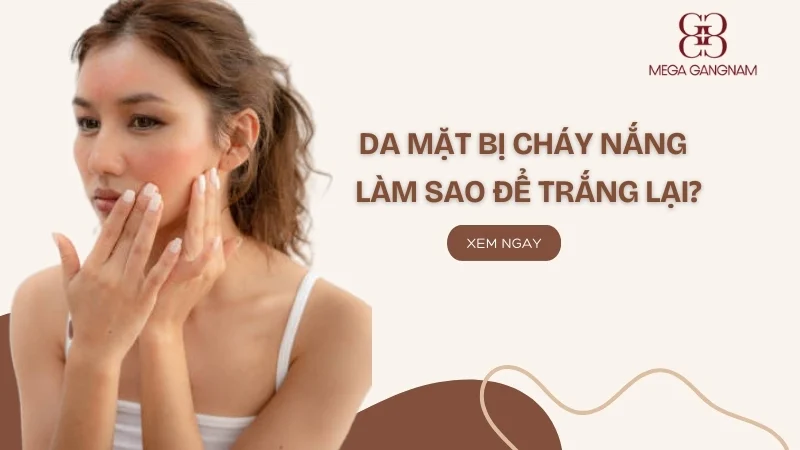 Da mặt bị cháy nắng làm sao để trắng lại?