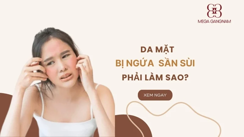 Da mặt bị ngứa sần sùi phải làm sao?