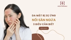 3 điều cần biết khi da mặt bị dị ứng nổi sần ngứa