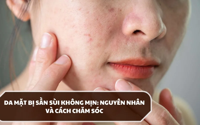 Da mặt bị sần sùi không mịn là do đâu và chăm sóc như thế nào hiệu quả? 