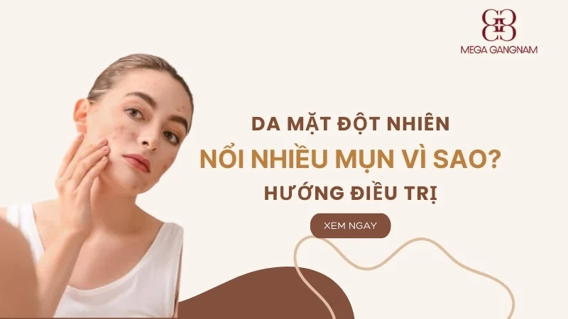 Vì sao da mặt đột nhiên nổi nhiều mụn? Hướng điều trị