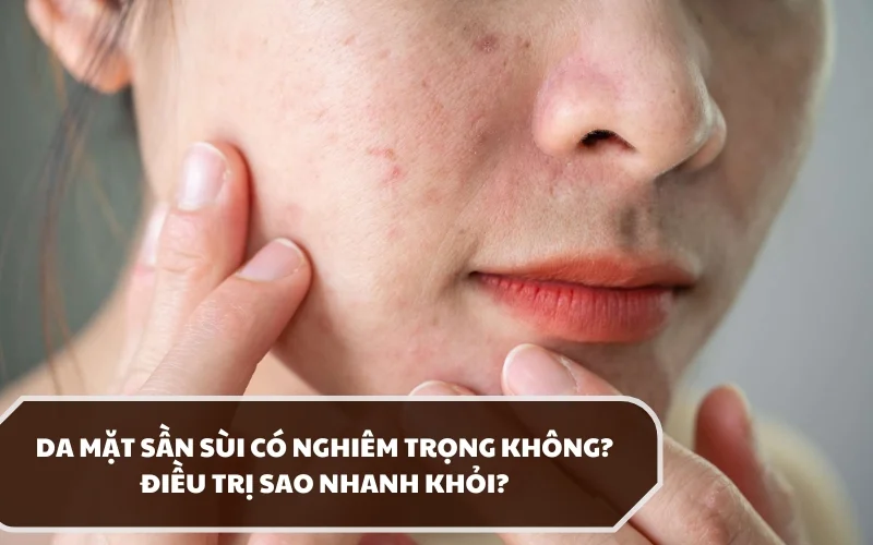 Hiện tượng da mặt sần sùi có biểu hiện, nguyên nhân và hướng điều trị như thế nào? 