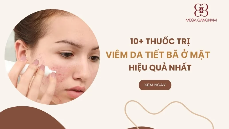 10+ thuốc trị viêm da tiết bã ở mặt hiệu quả nhất