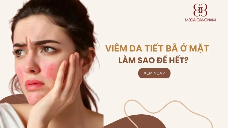 Viêm da tiết bã ở mặt làm sao để hết?