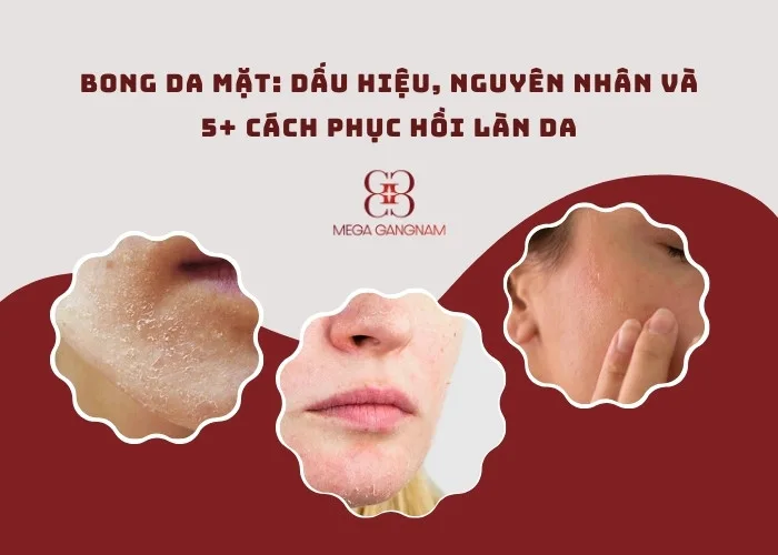 Bong da mặt: Dấu hiệu, nguyên nhân và 5+ cách phục hồi làn da