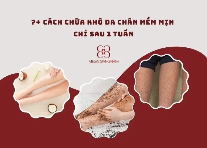 Top 7 cách chữa khô da chân mềm mịn chỉ sau 1 tuần