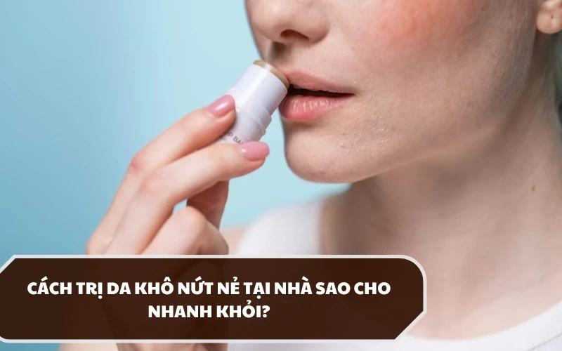 Nguyên nhân và cách trị da khô nứt nẻ hiệu quả nên áp dụng tại nhà 