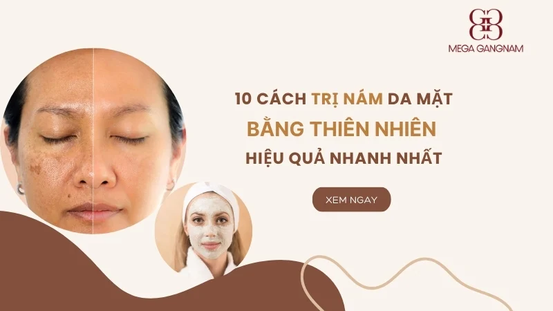 10 Cách trị nám da mặt bằng thiên nhiên hiệu quả nhanh