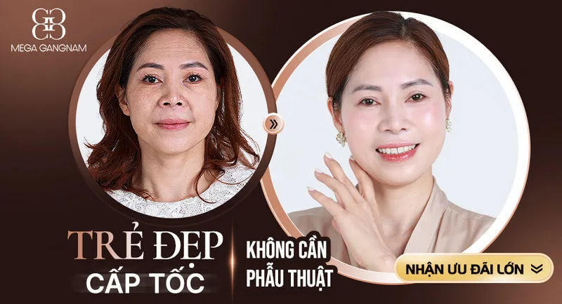 Da nhăn nheo, khô sạm, mất nước.. có thể khắc phục dễ dàng bằng Meta Elite mà không cần phẫu thuật 