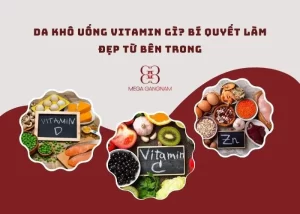 Da khô uống vitamin gì?