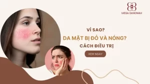 Vì sao da mặt bị đỏ và nóng bừng? Cách điều trị