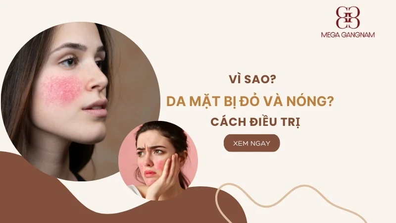 Vì sao da mặt bị đỏ và nóng bừng? Cách điều trị  