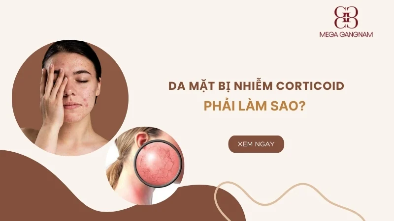 Da mặt bị nhiễm corticoid phải làm sao khắc phục? 