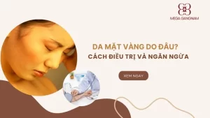 Da mặt vàng do đâu? Cách điều trị và ngăn ngừa hiệu quả