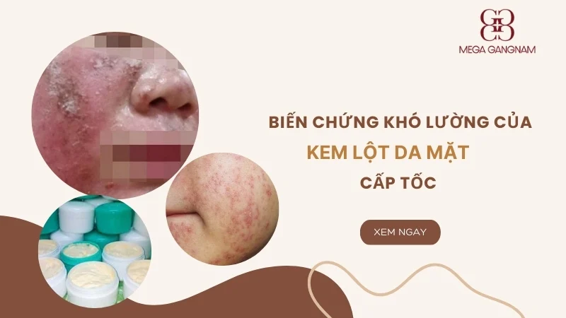 Biến chứng khó lường của kem lột da mặt cấp tốc