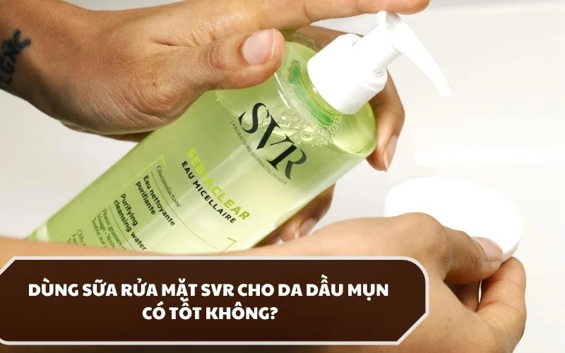 3 Dòng sữa rửa mặt SVR cho da dầu mụn được khuyến nghị sử dụng bởi chuyên gia da liễu