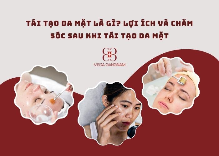 Tái tạo da mặt là gì? Lợi ích và chăm sóc sau khi tái tạo da mặt