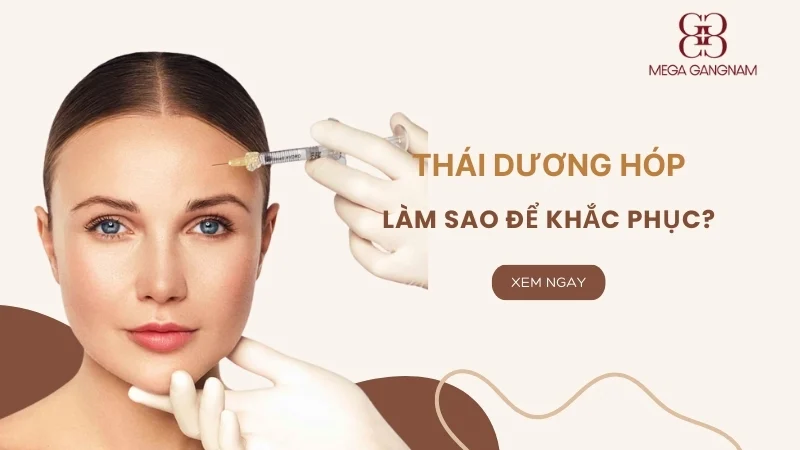 Thái dương hóp làm sao để khắc phục? 