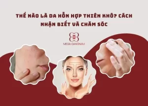 Thế nào là da hỗn hợp thiên khô?