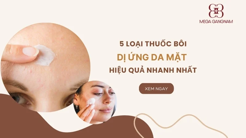 Gợi ý 5 loại thuốc bôi dị ứng da mặt hiệu quả nhanh 