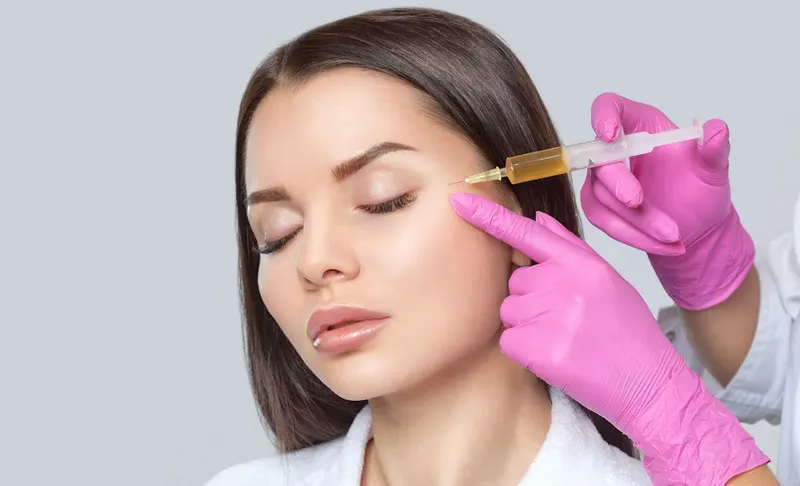 Tiêm filler thái dương chủ yếu sử dụng hoạt chất HA để làm đầy nếp nhăn, tăng thể tích da trẻ hóa thái dương 