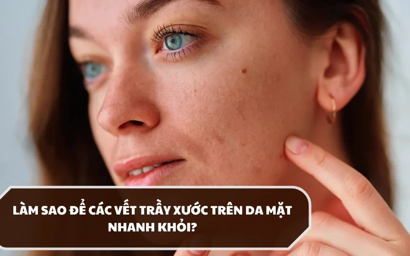 Làm cách gì để các vết trầy xước trên da mặt thật sự nhanh khỏi? 