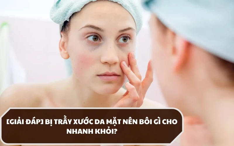 Bác sĩ da liễu khuyến nghị bị trầy xước da mặt nên bôi gì cho nhanh lành? 