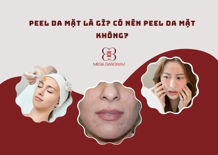 Peel da mặt là gì?