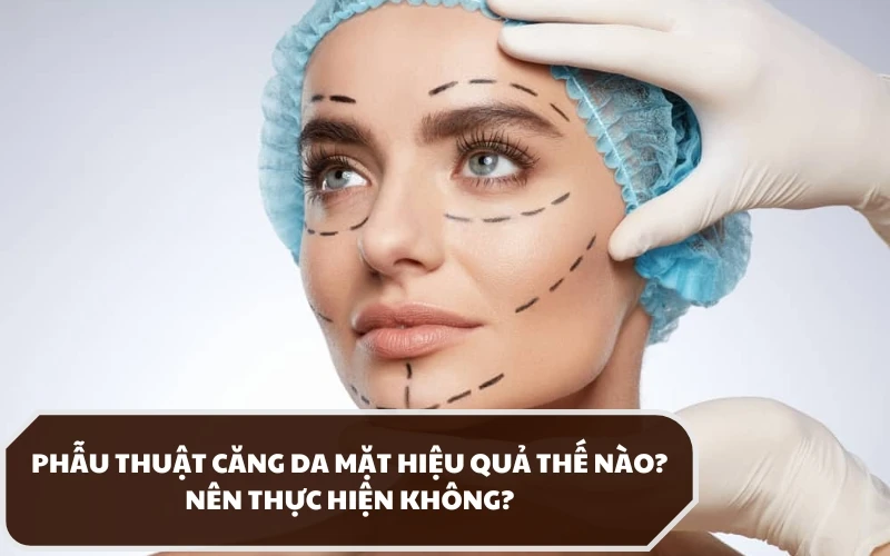 Phẫu thuật căng da mặt là phương pháp gì? Có những lợi ích như thế nào? 