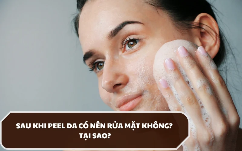 Giải đáp sau khi peel da có nên rửa mặt không? Nếu có thể thì cần tuân thủ những yêu cầu gì? 